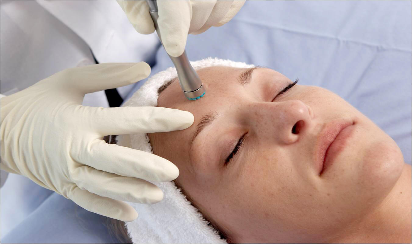 DermaSweep_Treatment